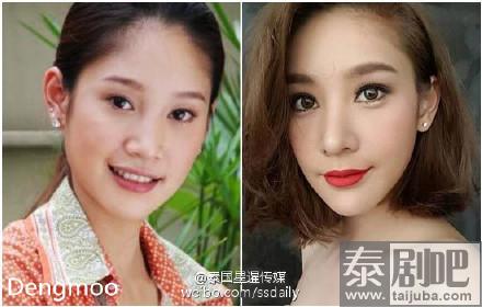 泰女星整容前后对比照